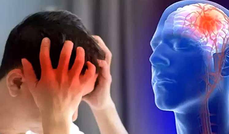 One in every four people over the age of 25 may experience stroke – health experts One in every four people over the age of 25 may experience stroke – health experts